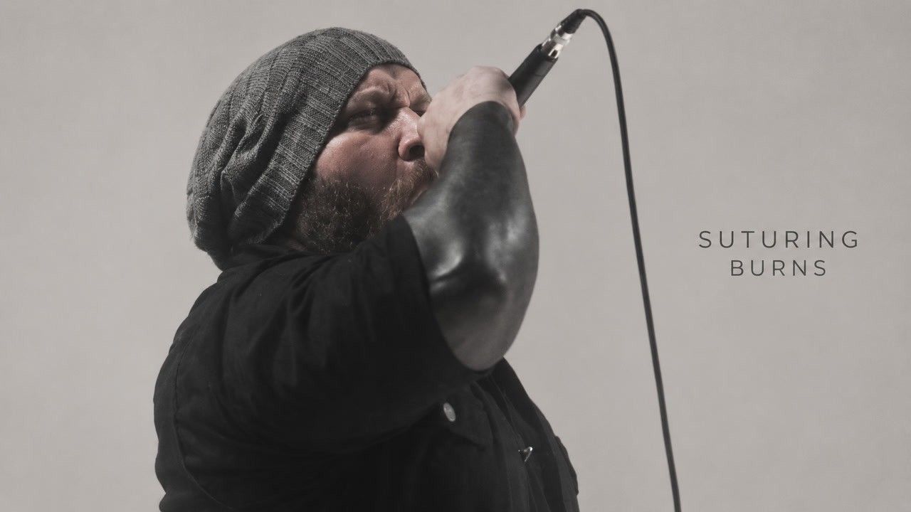 Suturing Burns — Official music video